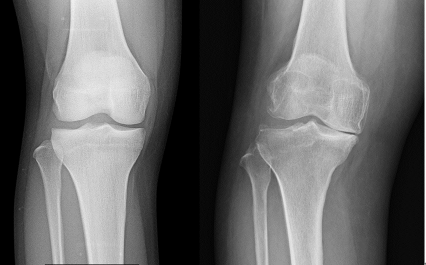 スポーツ・下肢（膝関節、足部・足関節） 千葉大学大学院医学研究院整形外科学